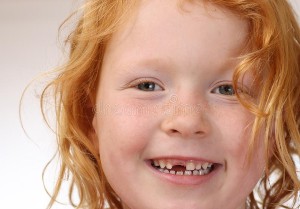 redhead little girl missing two front teeth
